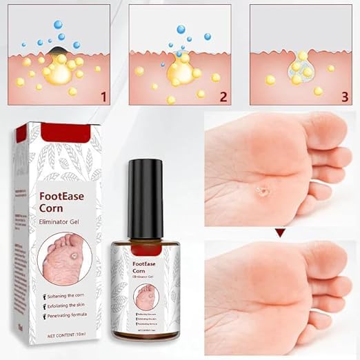 Feet Corn Removal Serum 30ml