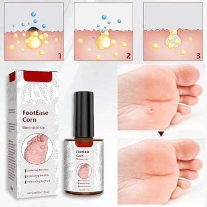 Feet Corn Removal Serum 30ml