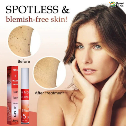 Tags & Moles Remover (Buy 1 Get 1 Free)