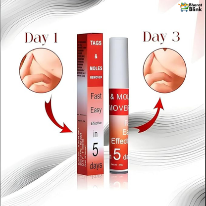 Tags & Moles Remover (Buy 1 Get 1 Free)