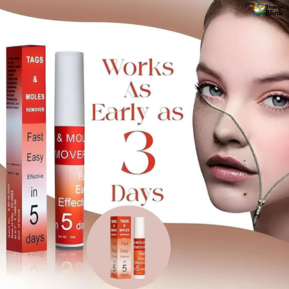 Tags & Moles Remover (Buy 1 Get 1 Free)
